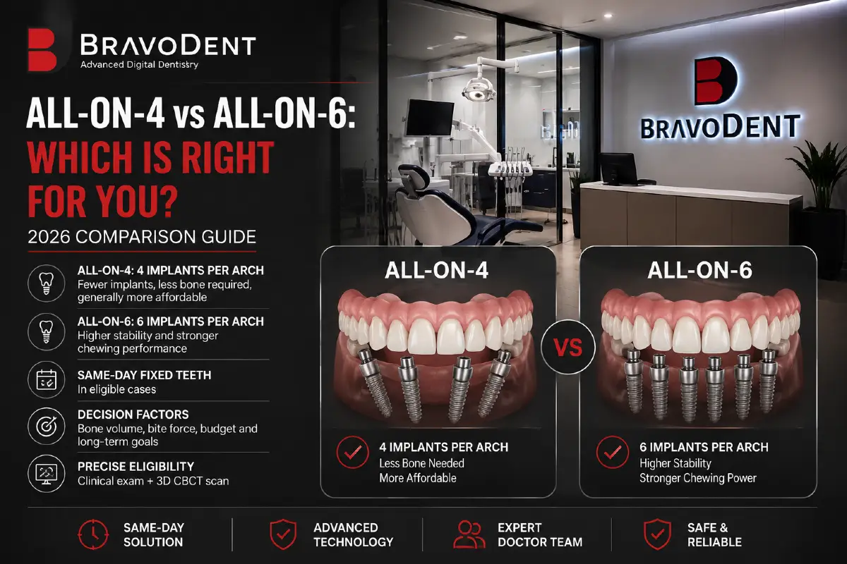 All-on-4 vs All-on-6: Which Is Right for You? 2026 Comparison Guide
