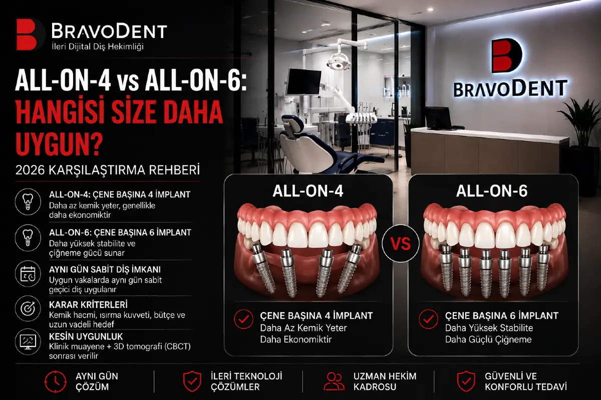 All-on-4 vs All-on-6: Hangisi Size Daha Uygun? 2026 Karşılaştırma Rehberi