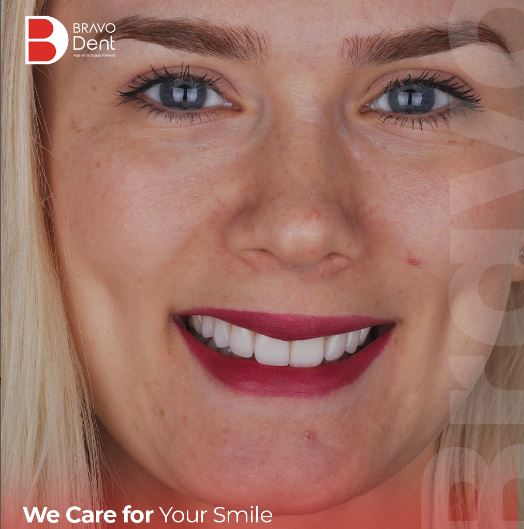 How long do dental implants last? Are dental implants permanent?