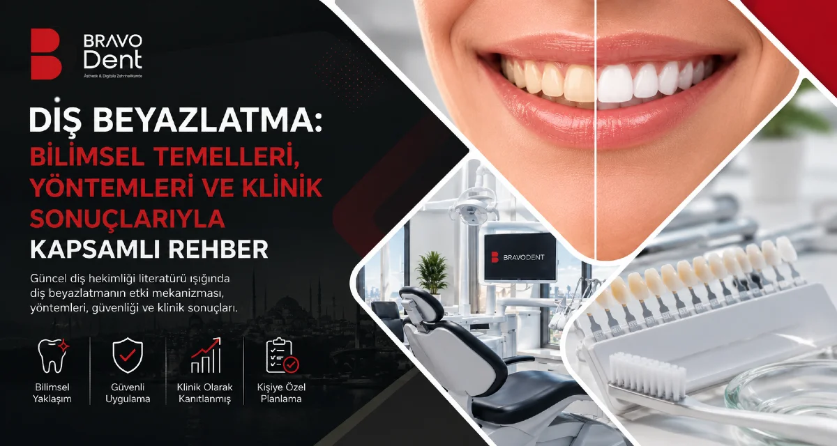 Diş Beyazlatma: Bilimsel Temelleri, Yöntemleri ve Klinik Sonuçlarıyla Kapsamlı Rehber