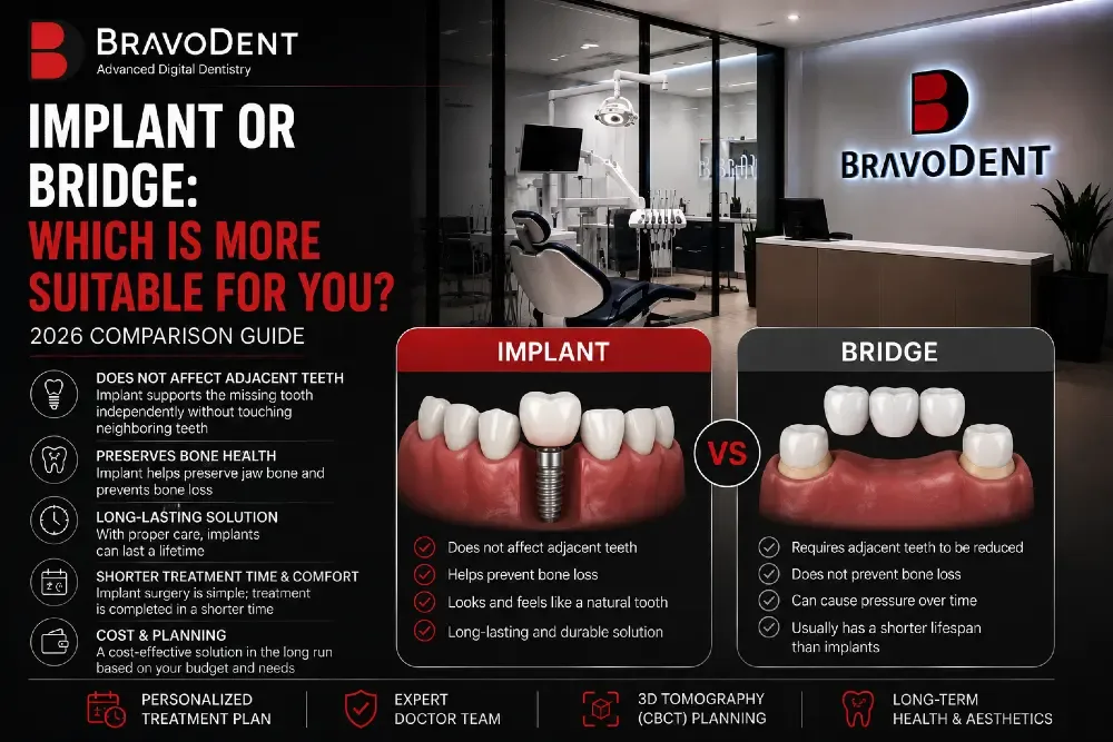 Implant vs Bridge: Which Is Right for You? 2026 Comparison Guide