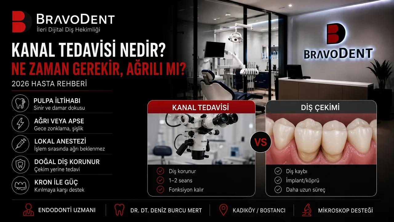 Kanal Tedavisi Nedir? Ne Zaman Gerekir, Ağrılı mı? İyileşme Süreci ve Sık Sorulan Sorular - Bravodent Diş Kliniği İstanbul