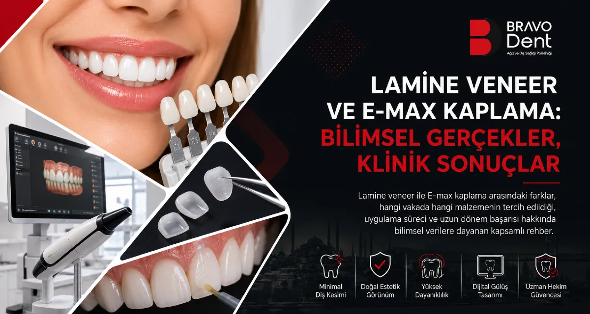 Lamine Veneer (E-max) Nedir? İstanbul'da Estetik Diş Hekimliğine Bilimsel Bir Bakış