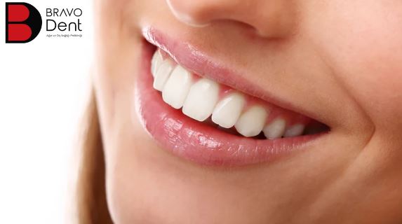 What should be considered after teeth whitening? Istanbul Turkey Dental Clinic