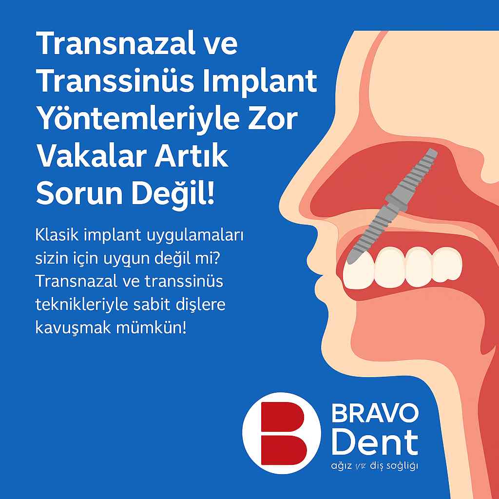 Transnazal ve Transsinüs İmplant Yöntemleriyle Zor Vakalar Artık Sorun Değil!