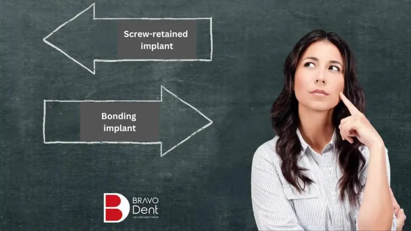Zygomatic implants Turkey